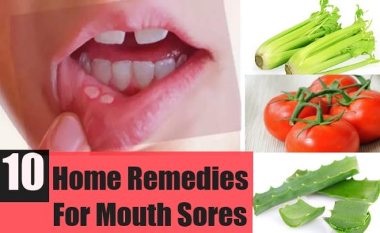 How do you cure mouth sores?