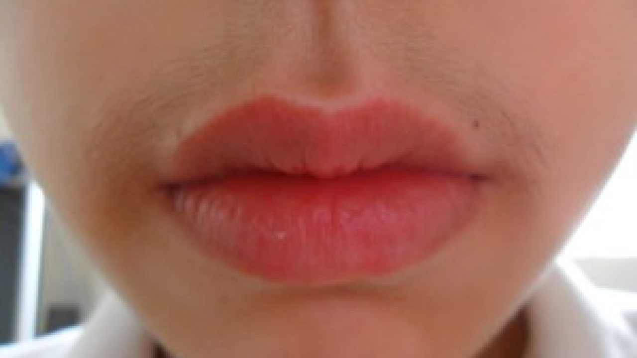 How to remove upper lip hair naturally, get rid, home remedies, tips, sensitive skin, women How to remove upper lip hair naturally, get rid, home remedies, tips, sensitive skin, women