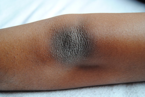 Dark skin on elbows