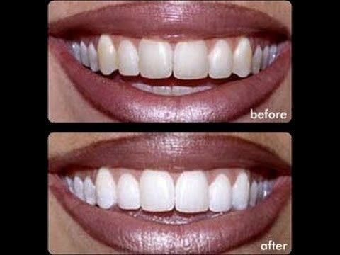 Turmeric skin whitening before and after