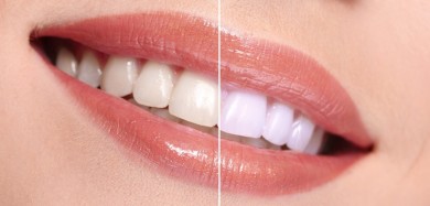 Whiten teeth with coconut oil