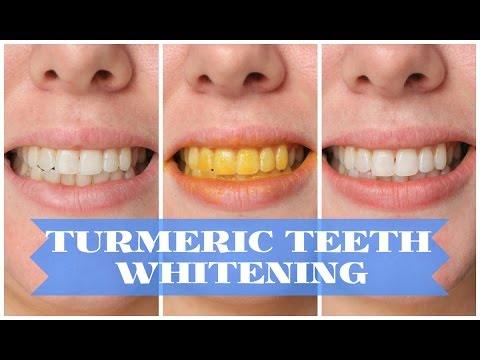 Turmeric for Teeth Whitening