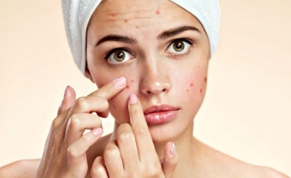 Carrot Seed Oil for Acne