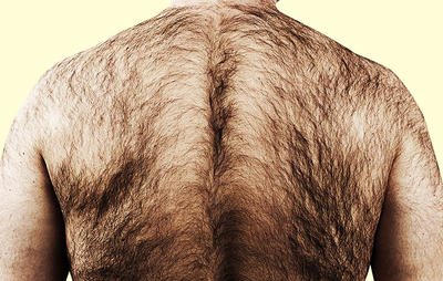 Back Hair Removal