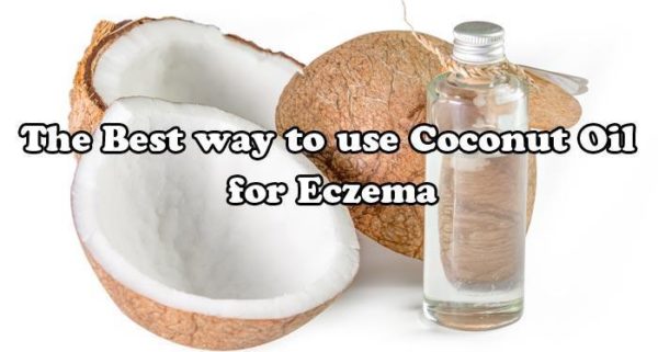 How to use Coconut Oil for Eczema